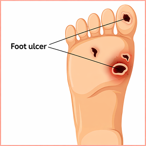 Enfermedades infecciosas